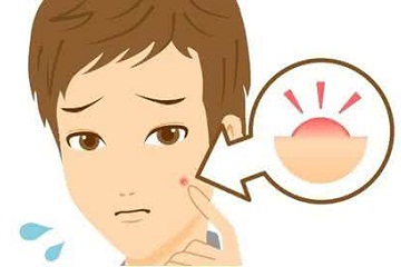 青春痘的危害有哪些